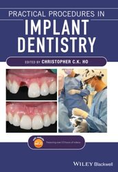 Practical Procedures in Implant Dentistry , Paperback by Ho, CCK