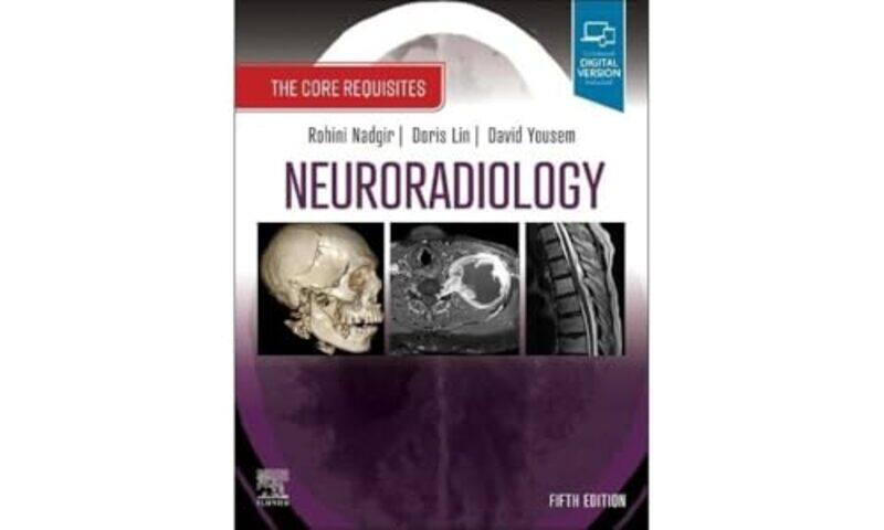 

Neuroradiology by Claire Wasserman-Paperback