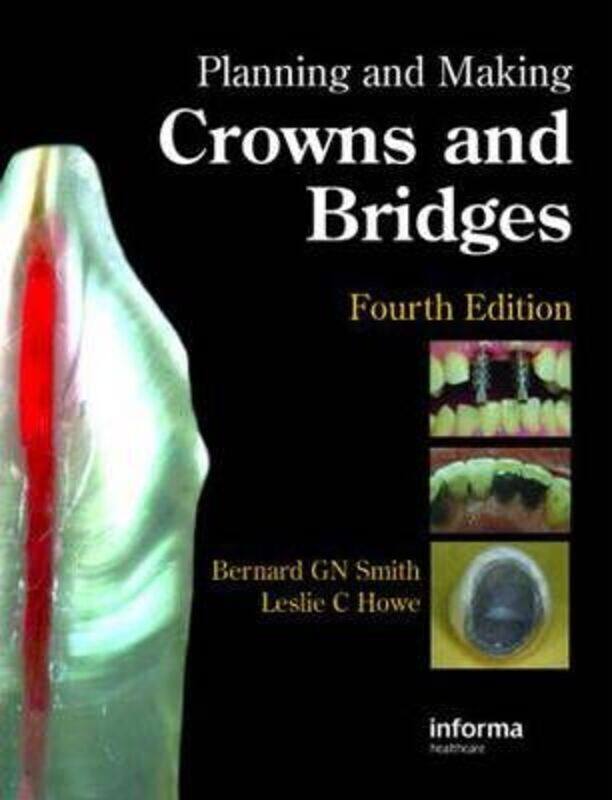 

Planning and Making Crowns and Bridges.Hardcover,By :Smith, Bernard G. N. (Formerly Guy's Hospital, London, UK) - Howe, Leslie C. (Guy's Hospital, Lon