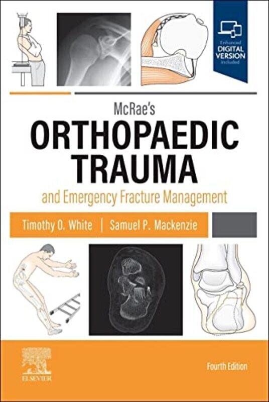 

Mcraes Orthopaedic Trauma And Emergency Fracture Management by White, Timothy O, BMedSci, MBChB, FRCSEd (Tr & Orth), MD (Consultant Orthopaedic Trauma