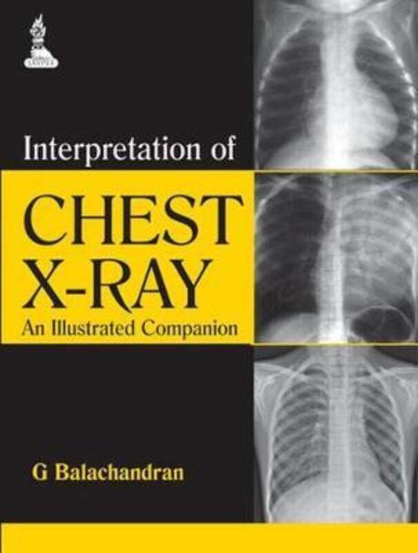 

Interpretation of Chest X-Ray: An Illustrated Companion,Paperback,ByBalachandran, G