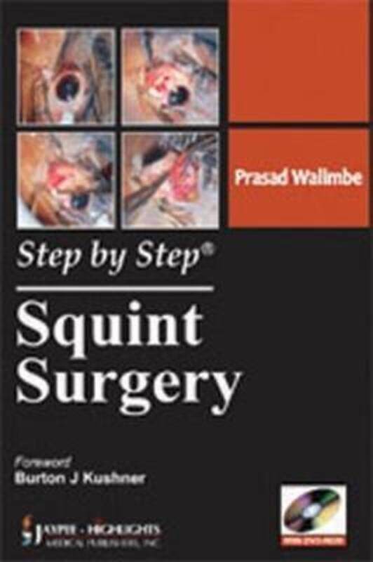 

Step by Step: Squint Surgery,Paperback,ByWalimbe, Prasad