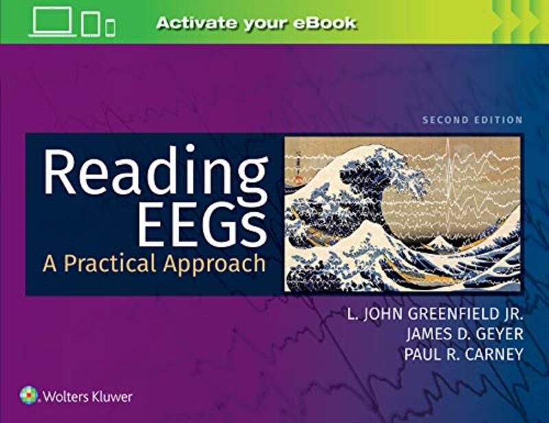 

Reading EEGs A Practical Approach by Clifford Jones-Paperback