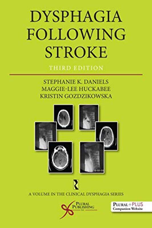 

Dysphagia Following Stroke by Dimitra Jackson SmithSoko Starobin-Paperback