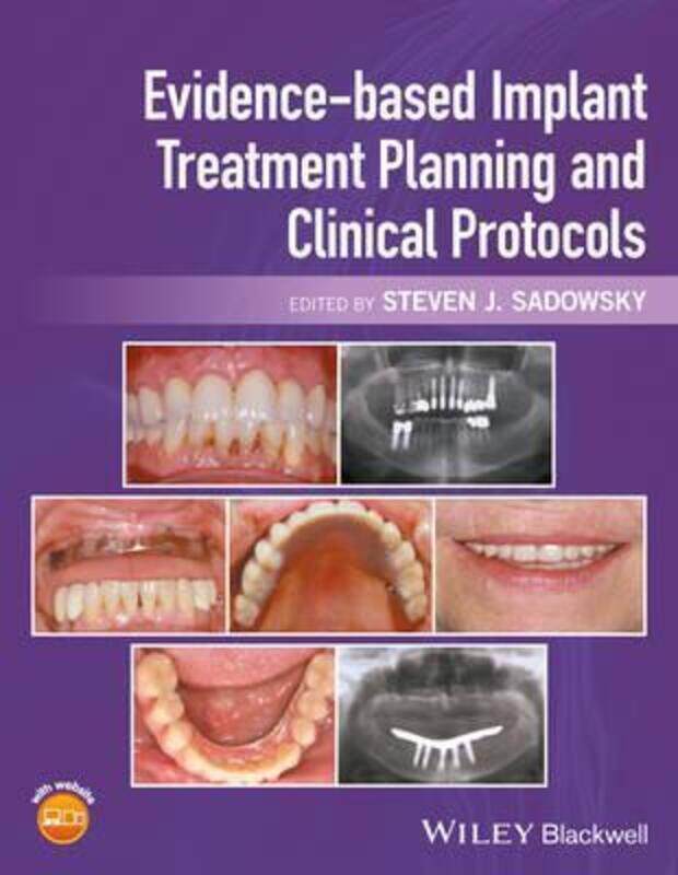 

Evidence-based Implant Treatment Planning and Clinical Protocols.Hardcover,By :Sadowsky, Steven J.