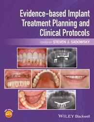 Evidence-based Implant Treatment Planning and Clinical Protocols.Hardcover,By :Sadowsky, Steven J.