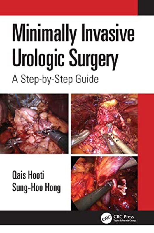 

Minimally Invasive Urologic Surgery by S Musheer Hussain-Paperback