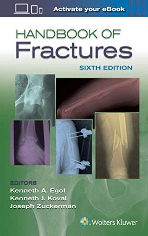 

Handbook of Fractures by Lisa RobinsonStacy Innerst-Paperback