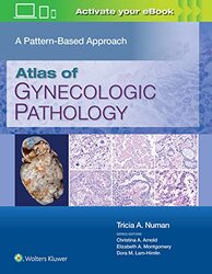 Atlas of Gynecologic Pathology by Christina University of Edinburgh BoswellEmile University of Edinburgh Chabal-Hardcover