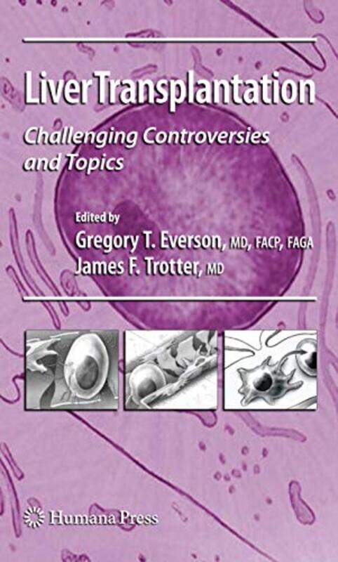 

Liver Transplantation by Felix Scheinberger-Paperback