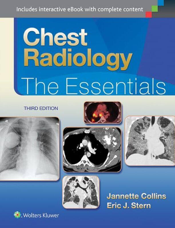 

Chest Radiology The Essentials by Maartje De MeulderJoseph J MurrayRachel L McKee-Hardcover