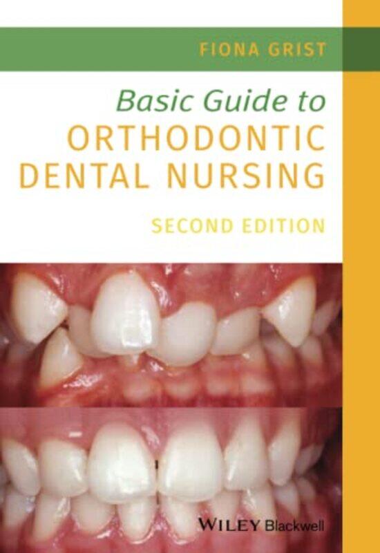 

Basic Guide to Orthodontic Dental Nursing by Steven De Montfort University GriggsDavid University of Essex Howarth-Paperback