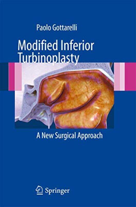 

Modified Inferior Turbinoplasty by The Irish Jesuits-Paperback