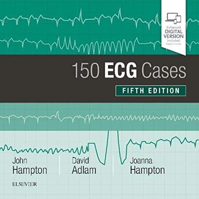 

150 Ecg Cases By John Hampton Paperback