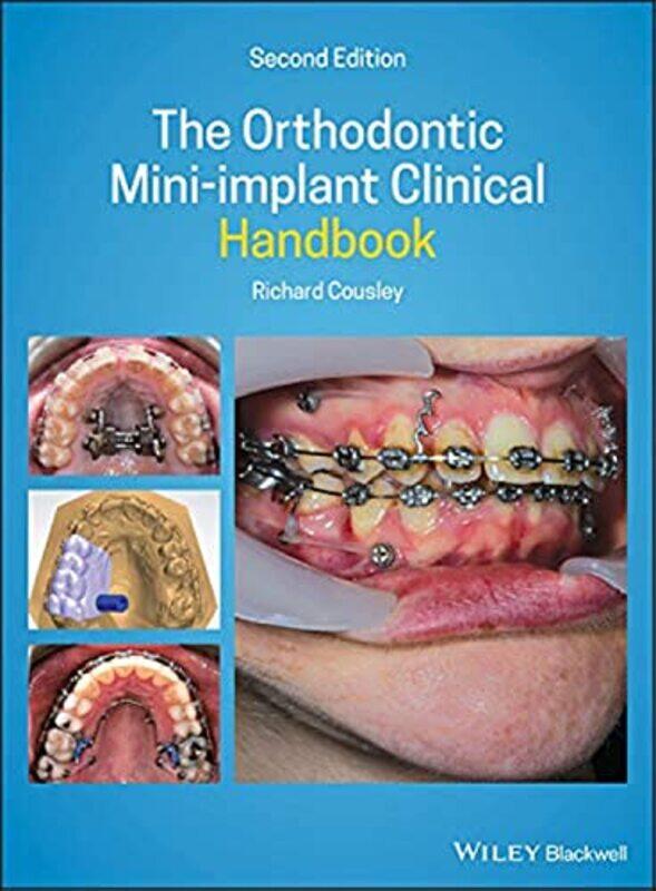 

The Orthodontic Miniimplant Clinical Handbook by David Milch-Hardcover