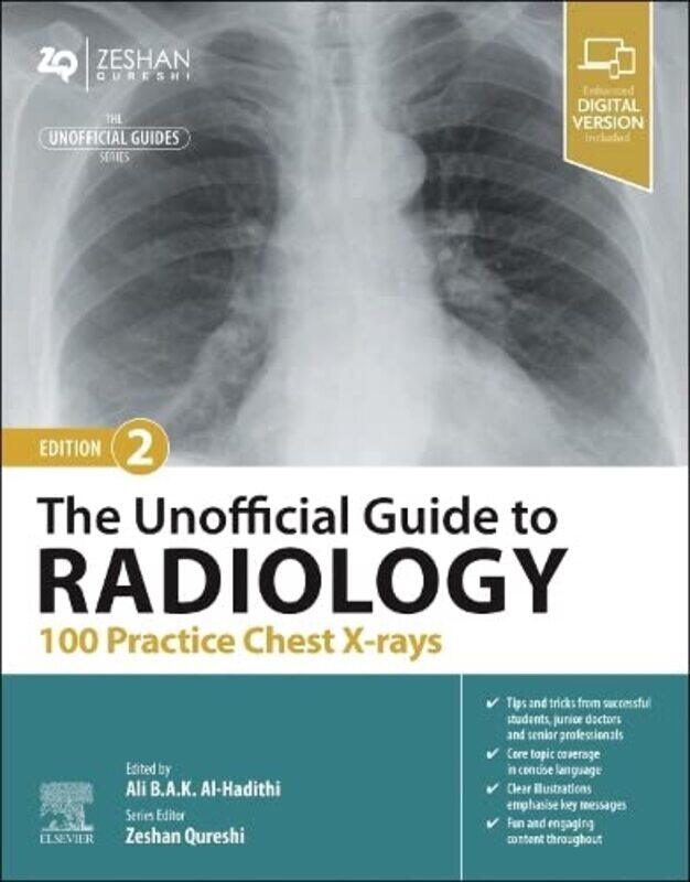 

The Unofficial Guide to Radiology 100 Practice Chest Xrays by Tony Bates-Paperback