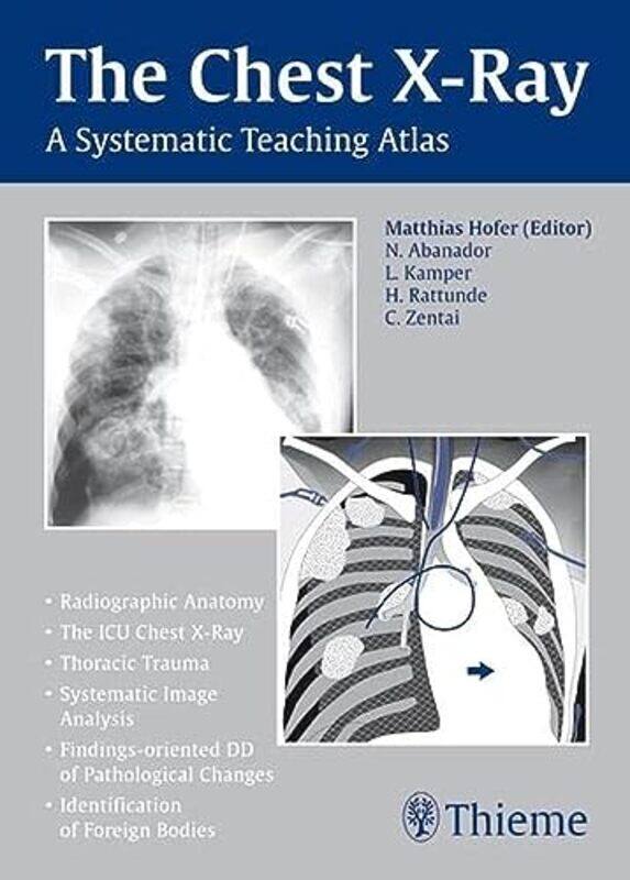 

The Chest XRay by Kevin Jarvis-Paperback