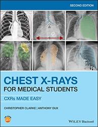 Chest XRays for Medical Students CXRs Made Easy by Clarke, Christopher (ST2 Clinical Radiology Trainee at Nottingham University Hospitals and Honorary Paperback