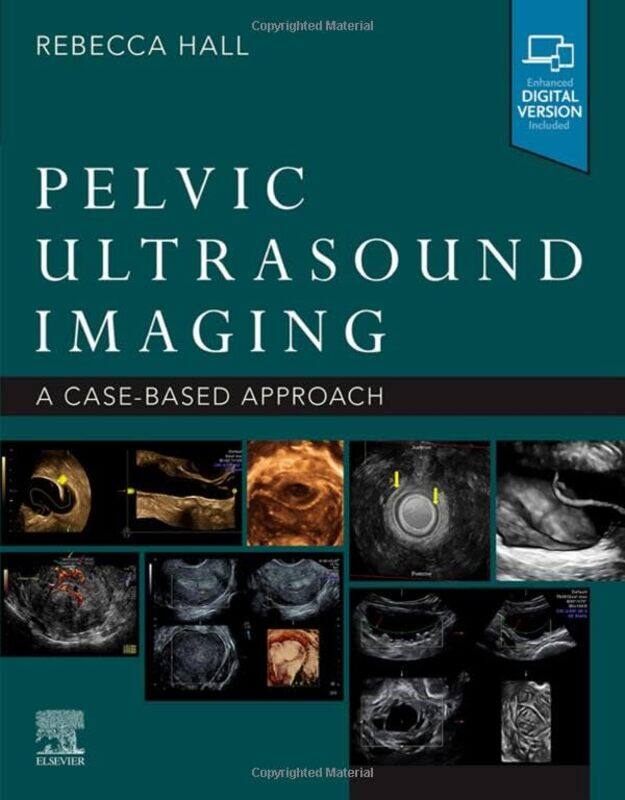 

Pelvic Ultrasound Imaging by William Anthony-Paperback