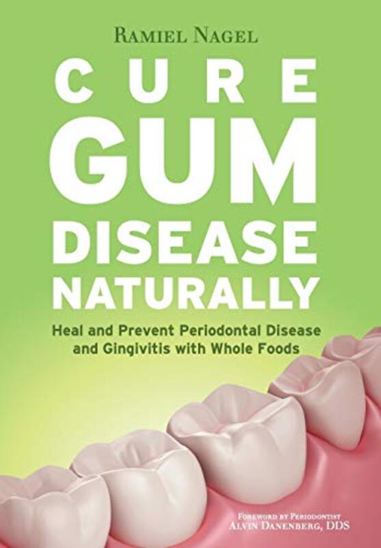 Cure Gum Disease Naturally Heal Gingivitis And Periodontal Disease With Whole Foods Nagel, Ramiel - Danenberg, Alvin, Dds Paperback
