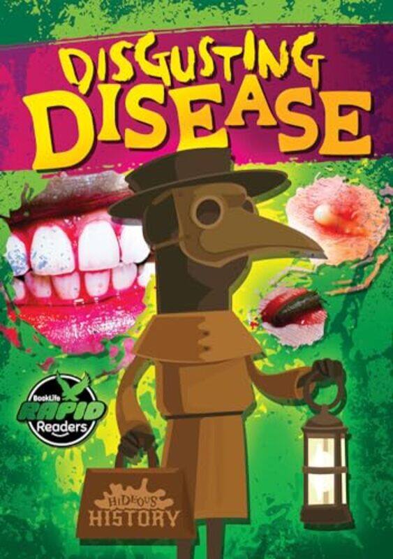 

Disgusting Disease by William Anthony-Paperback