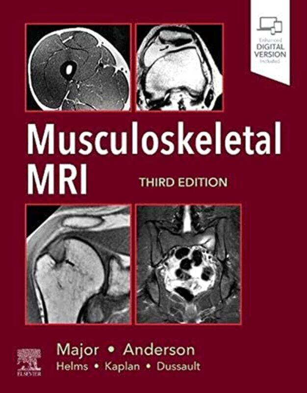 

Musculoskeletal Mri by Major, Nancy M. (Professor of Radiology and Orthopedics, University of Colorado School of Medicine, Hardcover