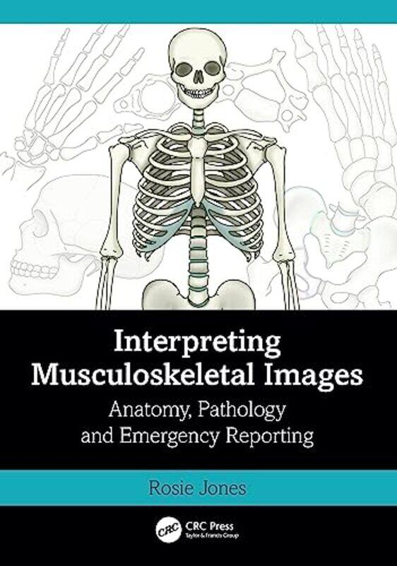 

Interpreting Musculoskeletal Images by EMC Education Services-Paperback
