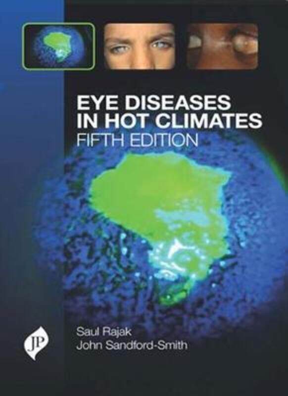 

Eye Diseases in Hot Climates,Paperback,ByRajak, Saul N.