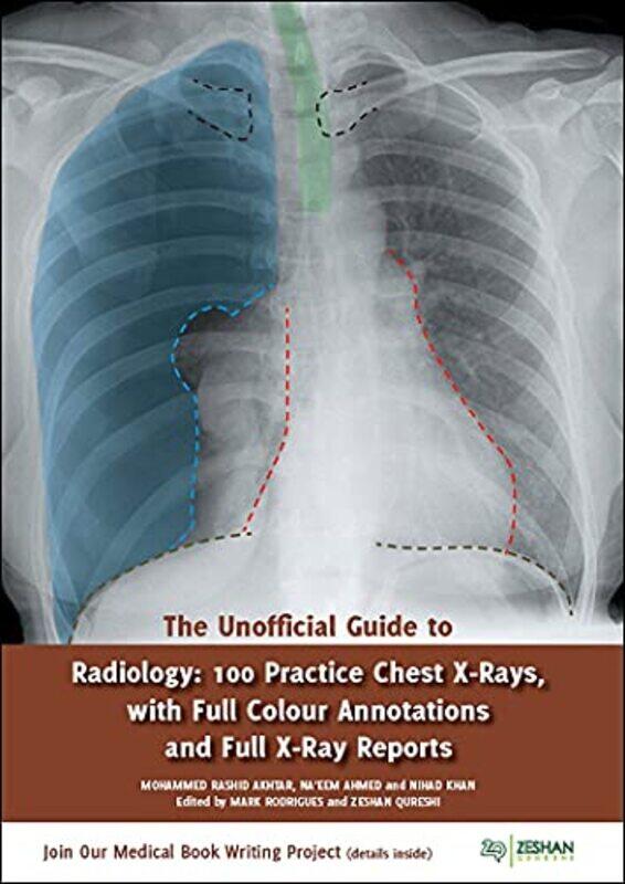 

Unofficial Guide to Radiology: 100 Practice Chest X Rays with Full Colour Annotations and Full X Ray,Paperback,By:Mohammed Rashid Akhtar