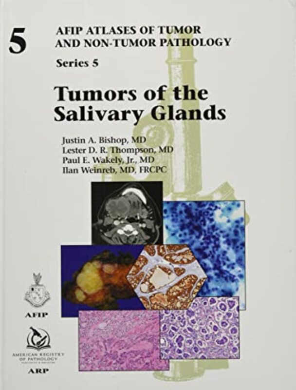 

Tumors of the Salivary Glands by Beth Kemp-Hardcover