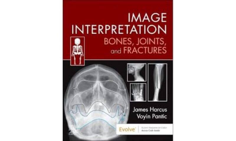 

Image Interpretation Bones Joints and Fractures by James Lecturer in Diagnostic Imaging, University of Leeds, UK HarcusVoyin Pantic-Paperback