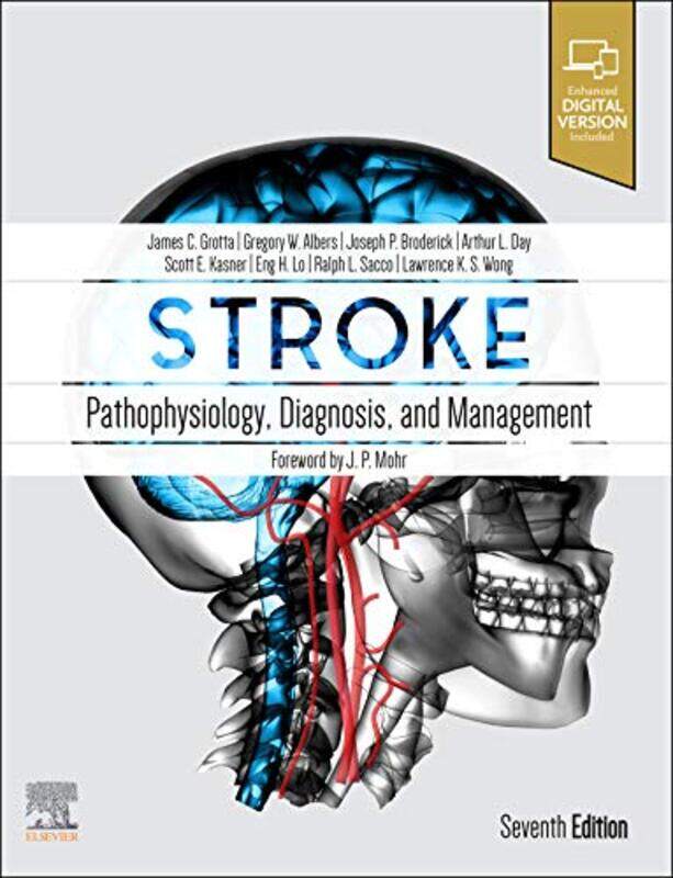 

Stroke by Carla Capalbo-Hardcover