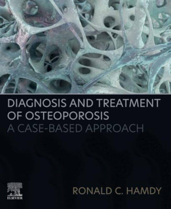 

Diagnosis And Treatment Of Osteoporosis by Ronald C Hamdy-Paperback