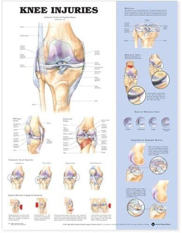 

Knee Injuries Anatomical Chart,Paperback by Anatomical Chart Company