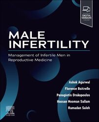 Male Infertility Management Of Infertile Men In Reproductive Medicine By Agarwal, Ashok (Head, Andrology Center, Director Of Research, American Center For Reproductive Medic - Paperback