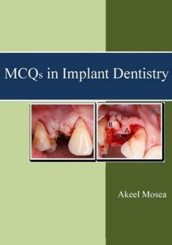 

MCQS in Implant Dentistry.paperback,By :Mosea, Akeel