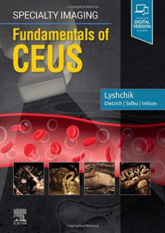

Specialty Imaging Fundamentals of CEUS by Monica Dunbar-Hardcover