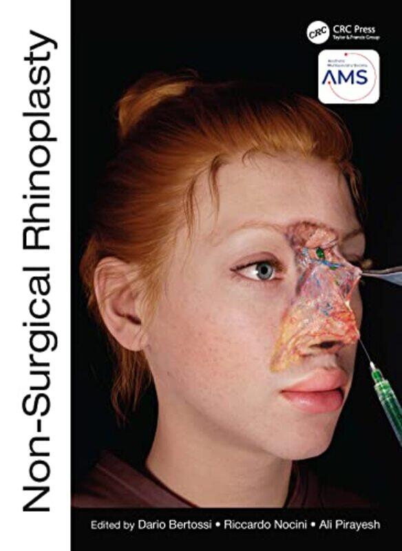 

NonSurgical Rhinoplasty by Dario Associate Professor in Maxillo Facial Surgery, Italy BertossiRiccardo NociniAli Pirayesh-Hardcover