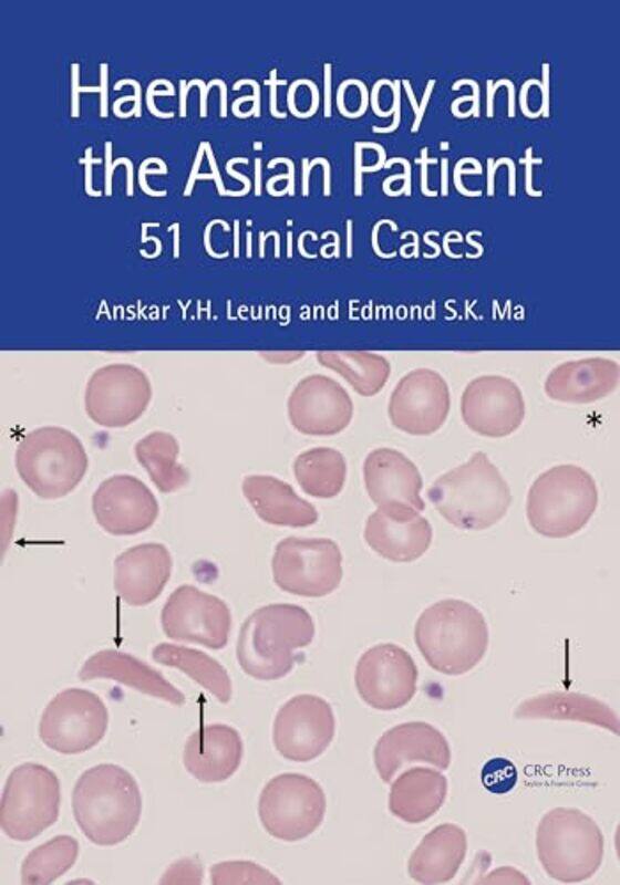 

Haematology and the Asian Patient by Anskar YH University of Hong Kong LeungEdmond S K Ma-Paperback