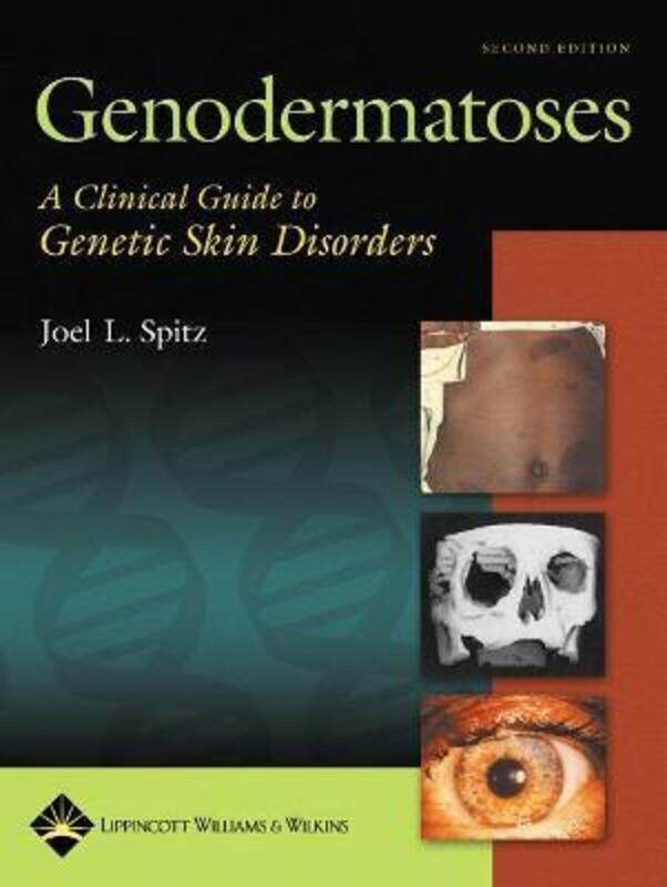 

Genodermatoses: A Clinical Guide to Genetic Skin Disorders,Hardcover,BySpitz, Joel L.