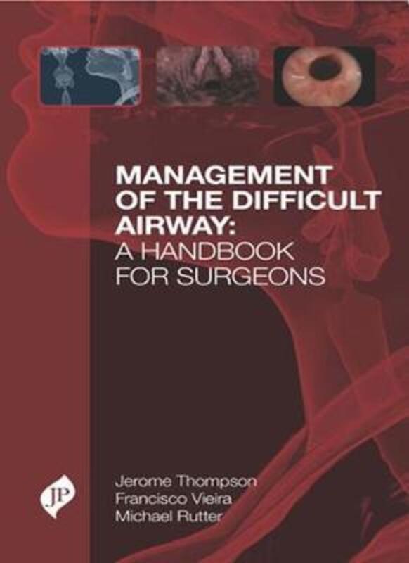 

Management of the Difficult Airway: A Handbook for Surgeons,Hardcover,ByThompson, Jerome - Vieira, Francisco - Rutter, Michael