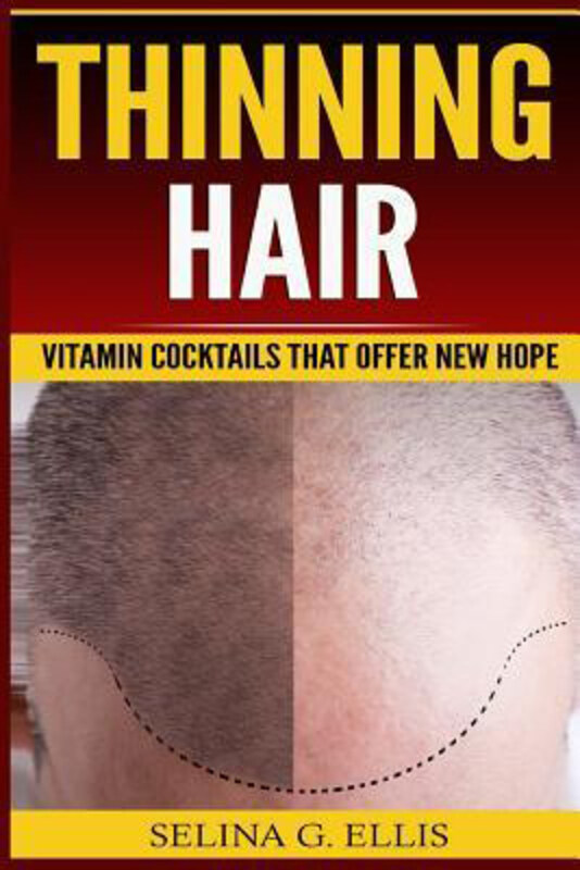 

Thinning Hair: Vitamin Cocktails That Offer New Hope, Paperback Book, By: Selina G Ellis