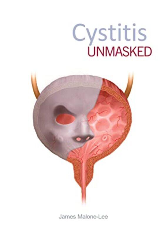 

Cystitis Unmasked by Charles-Franois LhomondRoberto Carfagni-Paperback