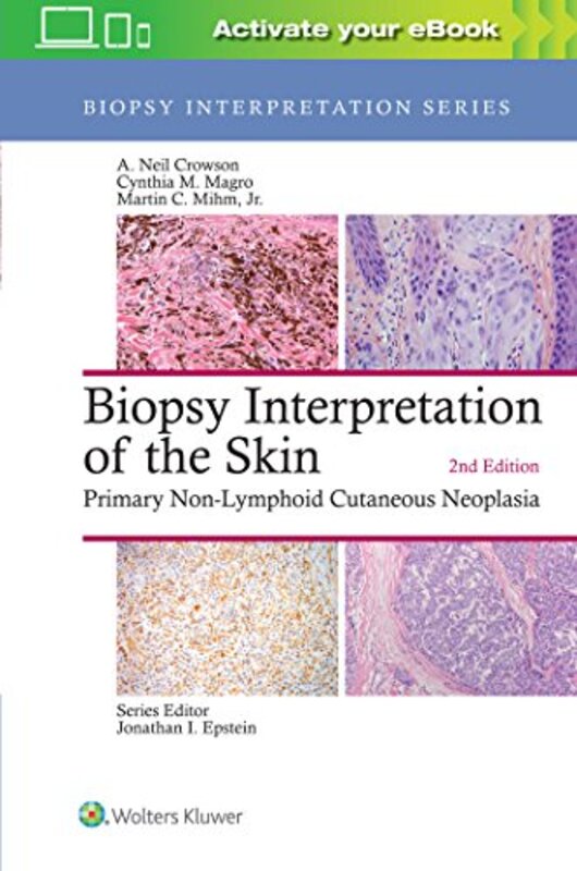 Biopsy Interpretation Of The Skin by A Neil CrowsonCynthia M Magro-Hardcover