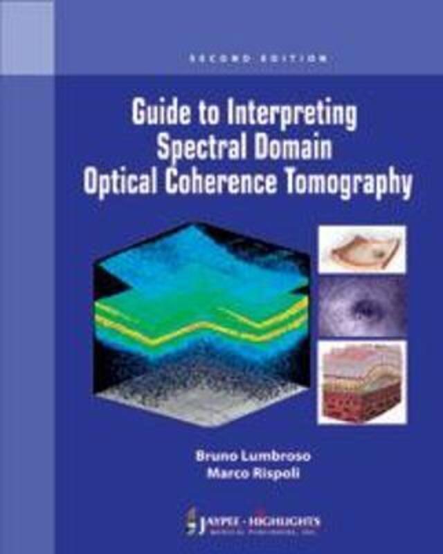 Guide to Interpreting Spectral Domain Optical Coherence Tomography.paperback,By :Lumbroso, Bruno - Rispoli, Marco