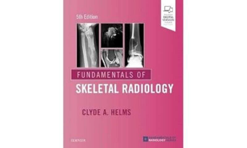 

Fundamentals of Skeletal Radiology by Idan Ben-BarakPhilip Bunting-Paperback