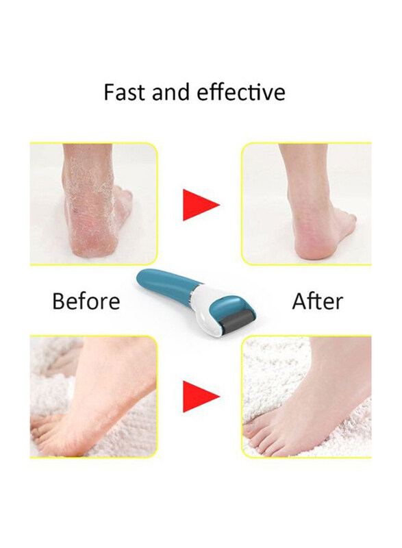 Abody Rechargeable Electric Callus Remover, W9727, Blue/White