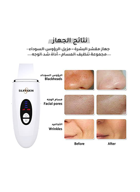 Silky Skin Skin Scrubber Blackhead Remover, White